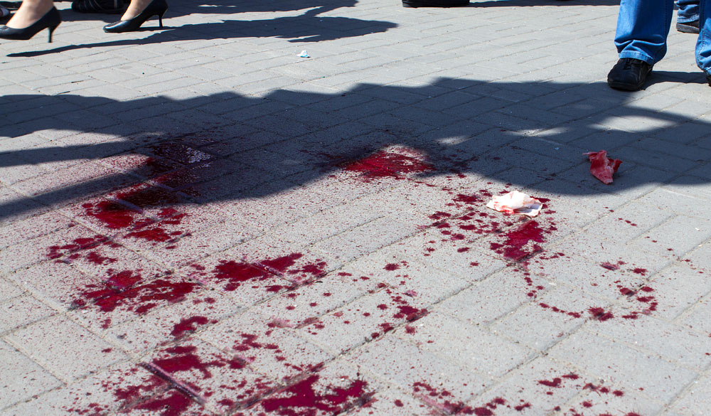 blood-pic4zoom-1000x1000-4670