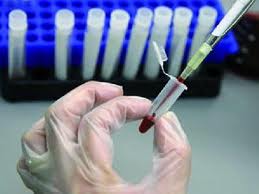 dvoeamerikancevizlechilisotvichspomoshchyuperesadkikostnogomozga