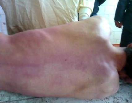 vozbuzhdenougolovnoedelopofaktusmertinizomiddina