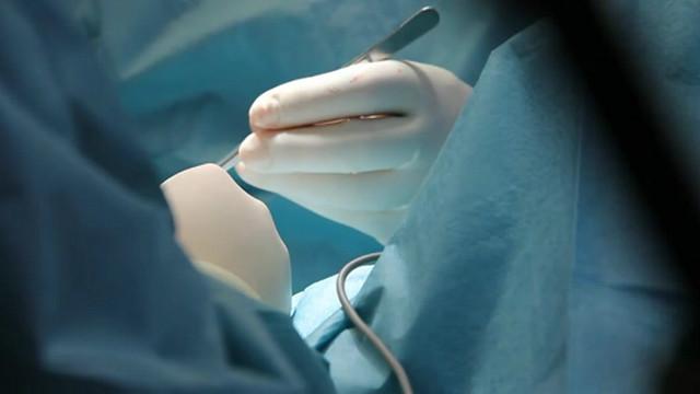 syunnet-toy-ili-obryad-obrezaniya