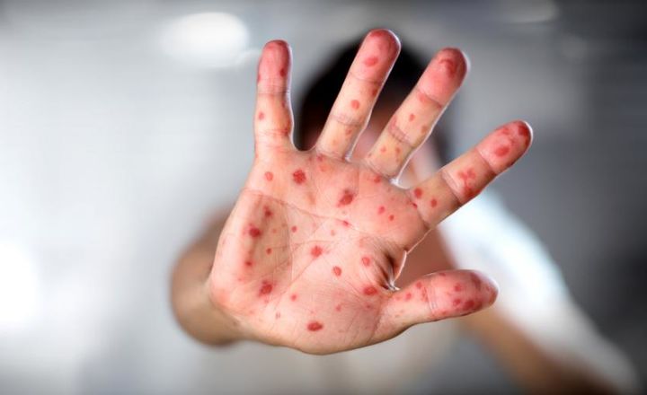 720_440_80_0d61acd3bf6a017fd4f74fb75e81df9f