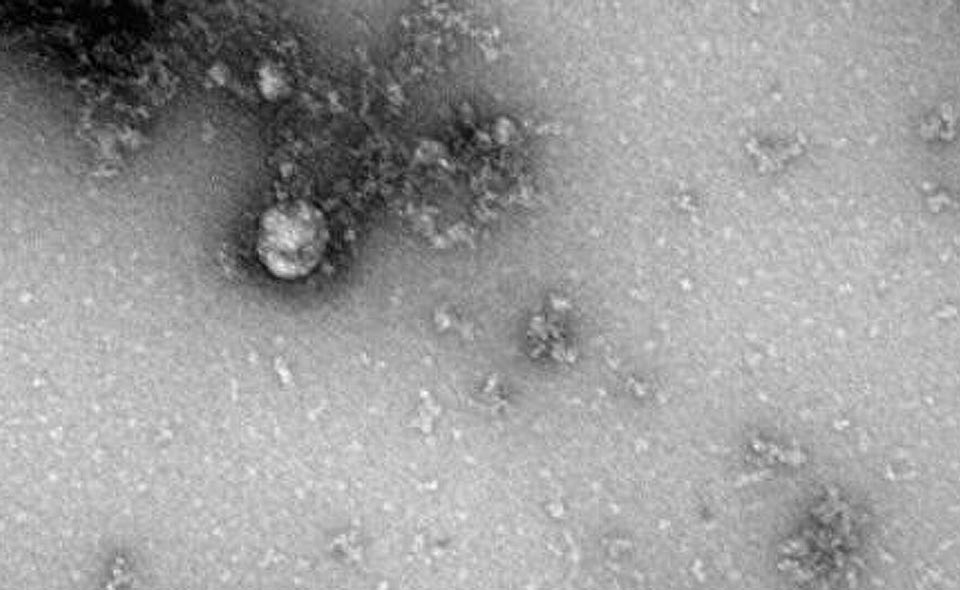 1594416112_0_105_470_369_1920x0_80_0_0_e0bd35d7087d867177ef93107b4f1b76