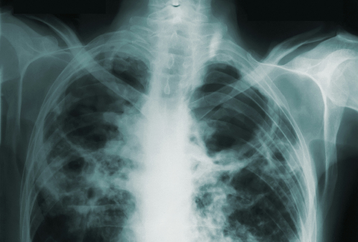 cdc-4U6qzwNu-Ns-unsplash